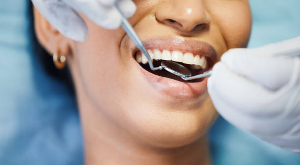 Best Emergency Dentist for Knocked-Out Tooth in Vassar College, NY