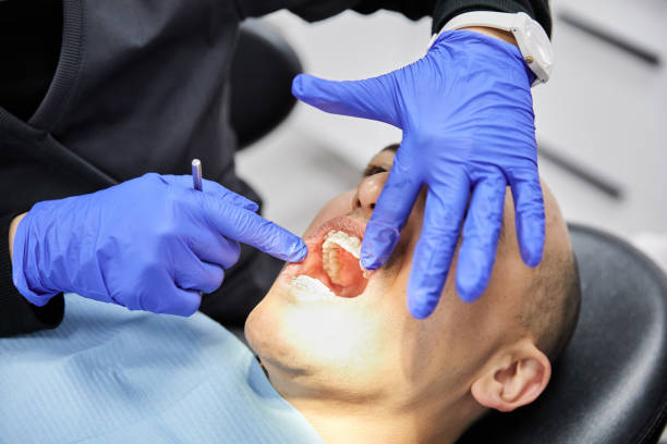 Best Emergency Dental Care for Abscessed Tooth in Vassar College, NY
